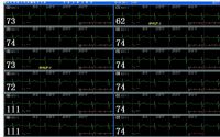 STY2011系列心電遙測(cè)中心監(jiān)護(hù)站