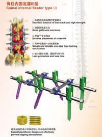 脊柱固定器