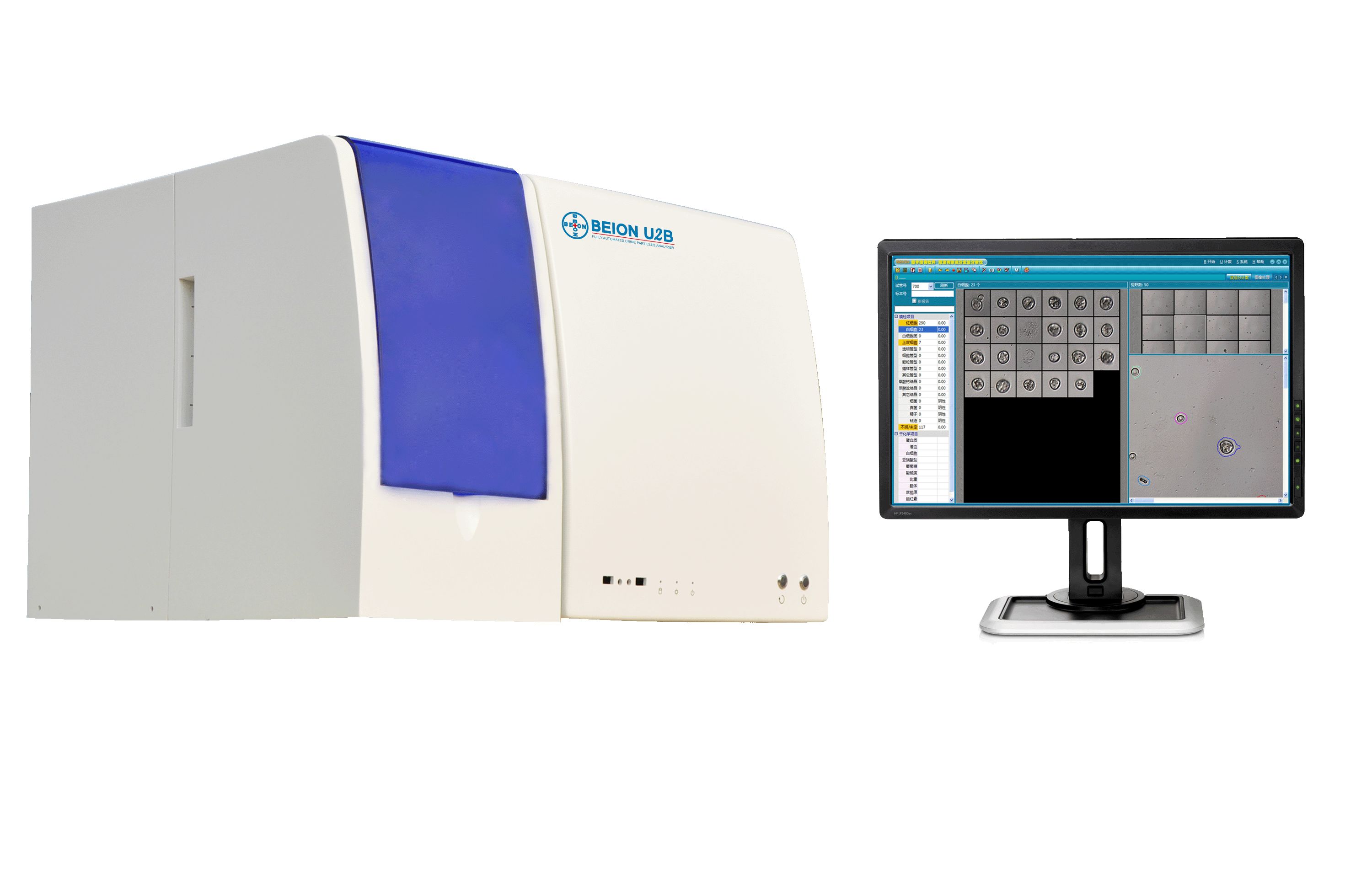 BEION 全自動(dòng)尿液有形成分分析儀