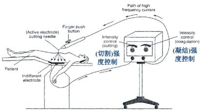 电刀的电凝和电切图解图片