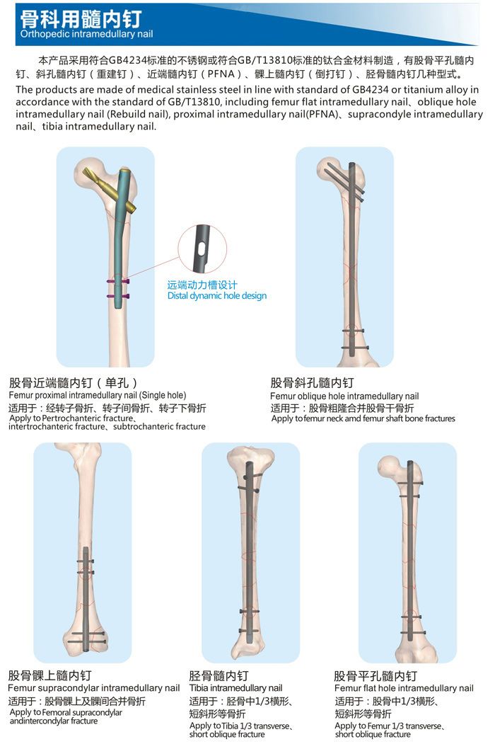 骨科用髓內(nèi)釘