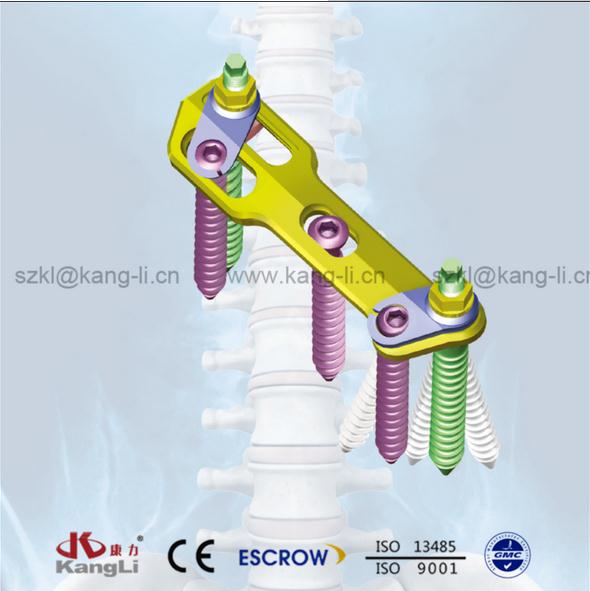 脊柱前路內(nèi)固定系統(tǒng)