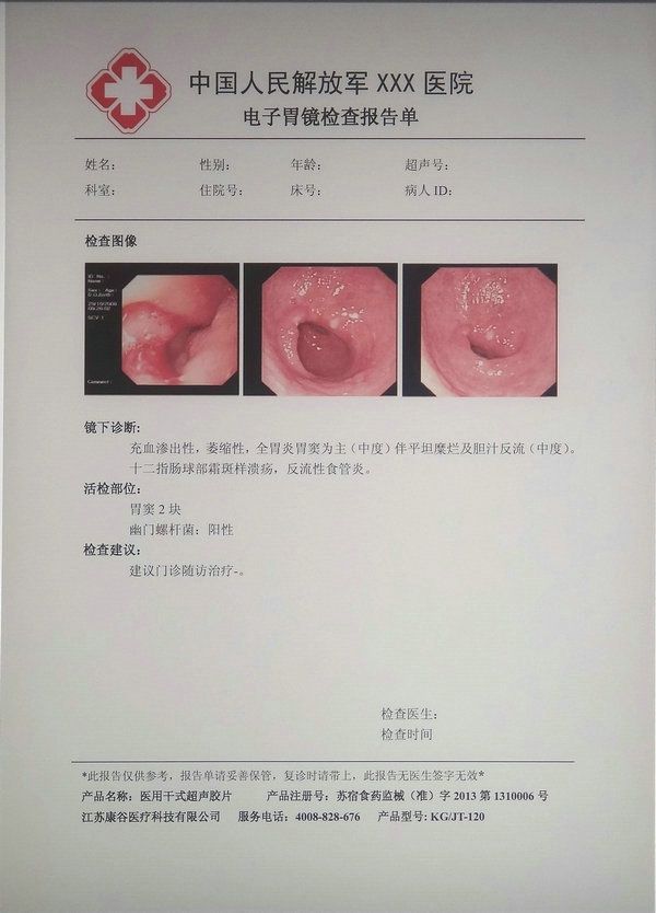 醫(yī)用干式超聲膠片