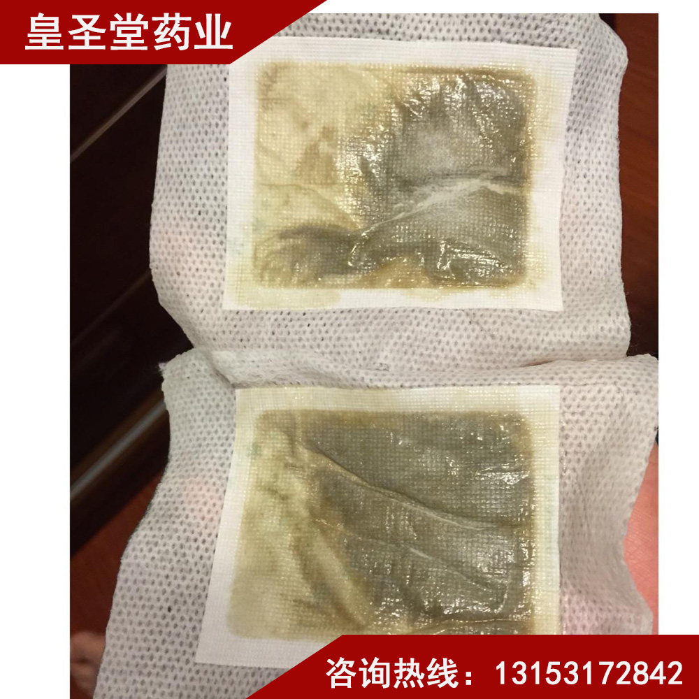 足貼祛濕有用嗎足貼的原理全國招商代理加工